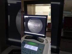 Machine à ondes de choc extracorporelle de haute précision, système de rayons X de lithoripsie à vitesse de choc.